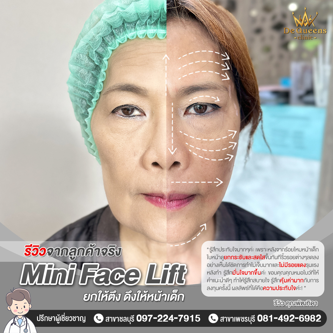 ภาพรีวิวลูกค้าร้อยไหม