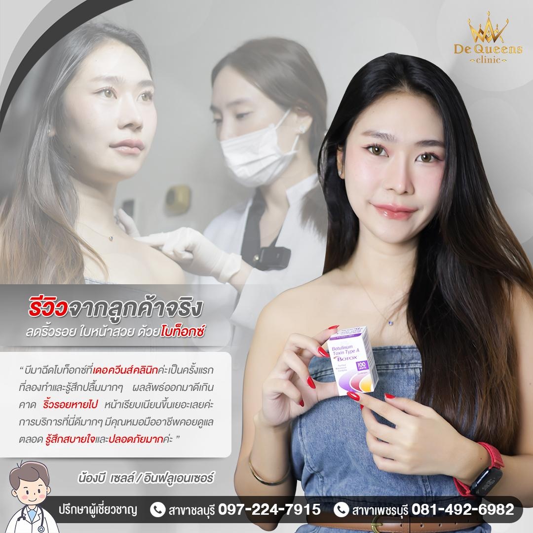 รีวิวโบท๊อกซ์ Botox จากลูกค้าจริง