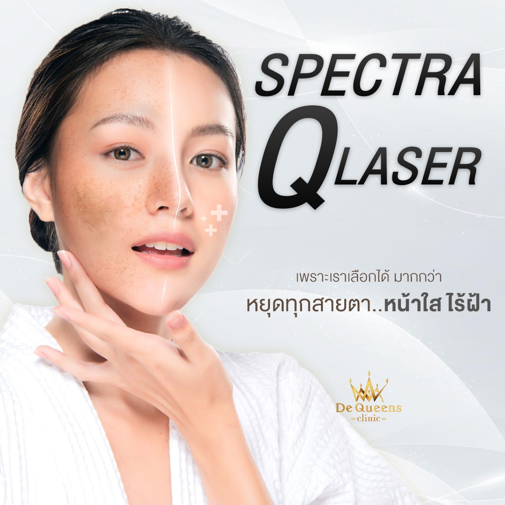 Spectra Q laser รักษาฝ้า ชลบุรี เพชรบุรี