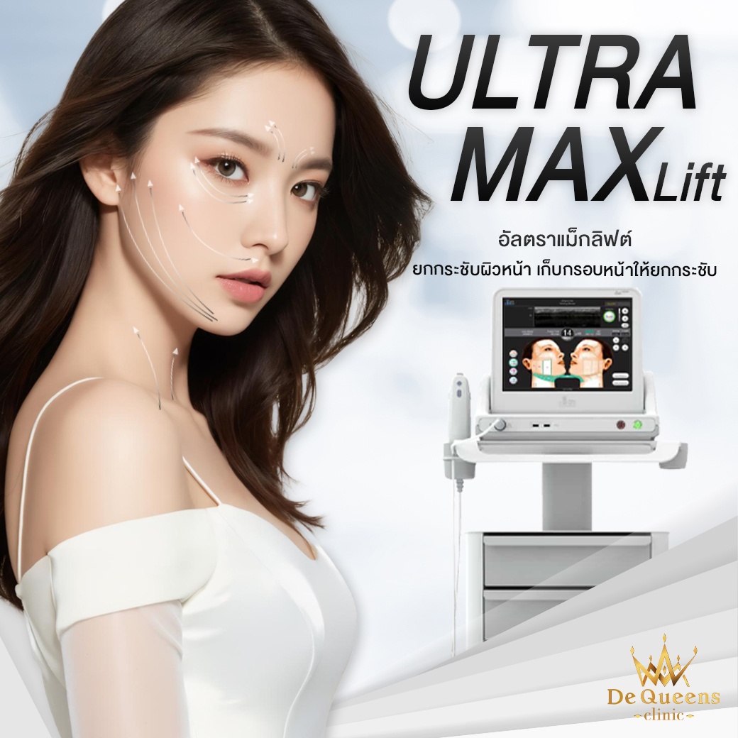 Ultra Max Lift ยกกระชับผิวหน้า (HIFU)