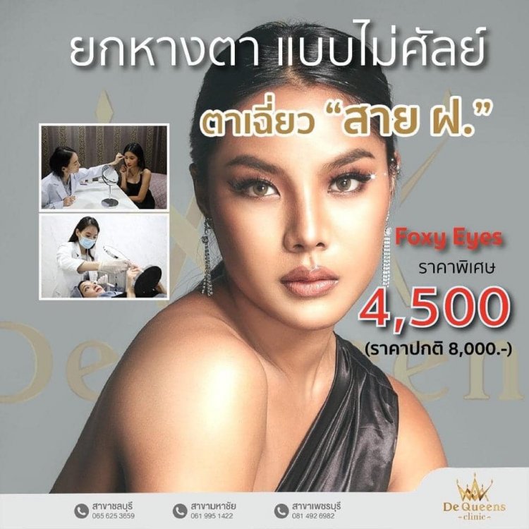 Foxy Eyes ยกหางตา แบบไม่ต้องศัลย์