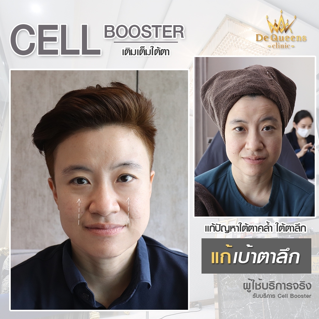 Cell Booster