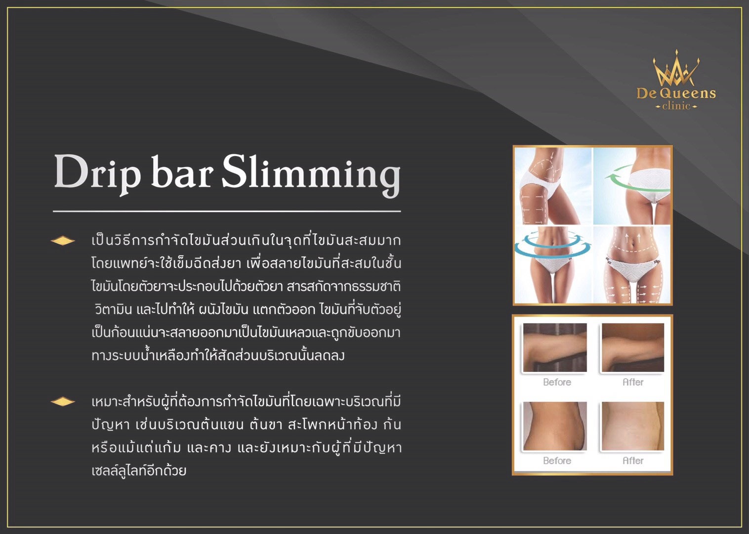 Drip bar Slimming